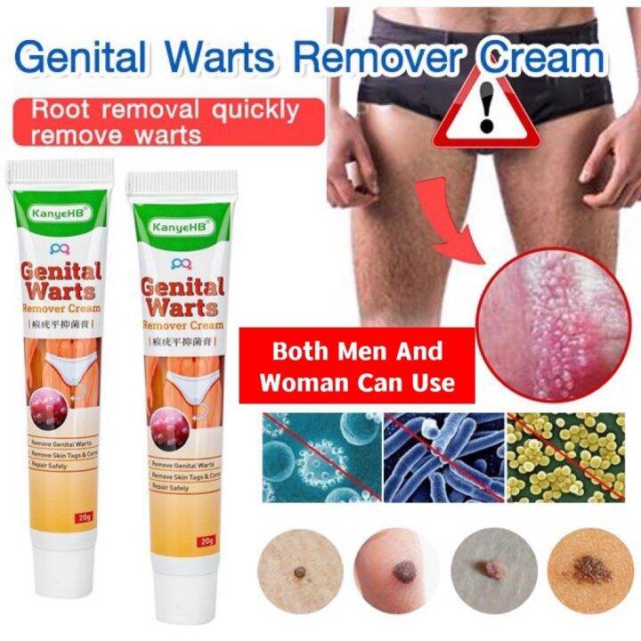 Free Shopping Warts Remover Original ☬ Genital Warts Remover Ointment Herpes Genital Condyloma 2482