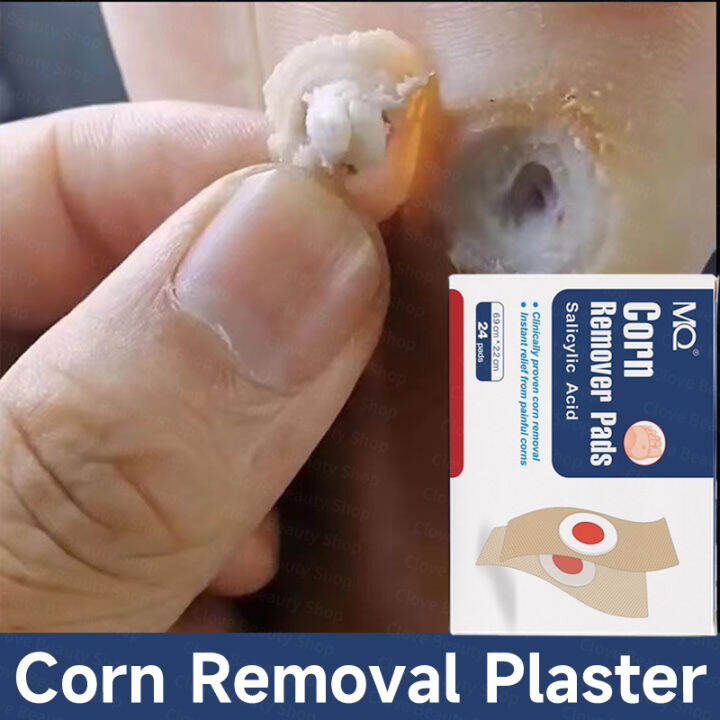 【Effective in 3days】24Pcs Feet Corns Warts Removal Patch Corns remover