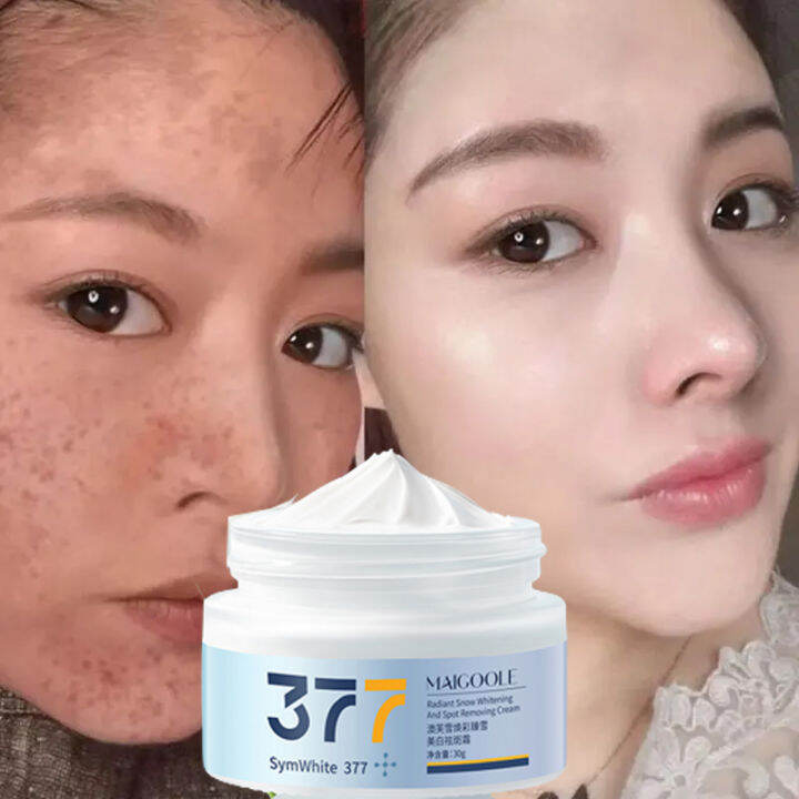 377 Whitening Melasma Cream 30g Whitening & Freckle Remover Cream ...