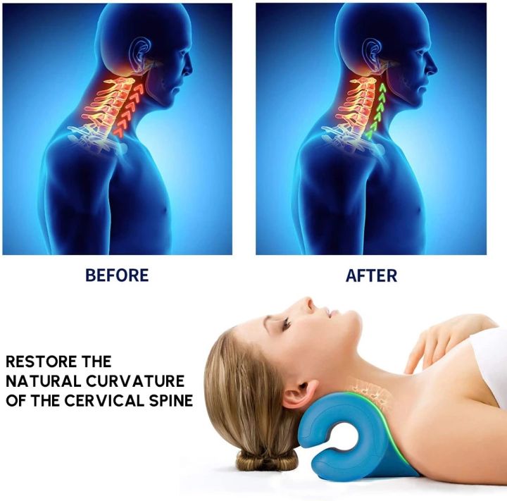 neck-amp-shoulder-relaxer-cervical-neck-traction-device-for-neck-stiffness-neck-stretcher-chiropractic-pillow-traction-support