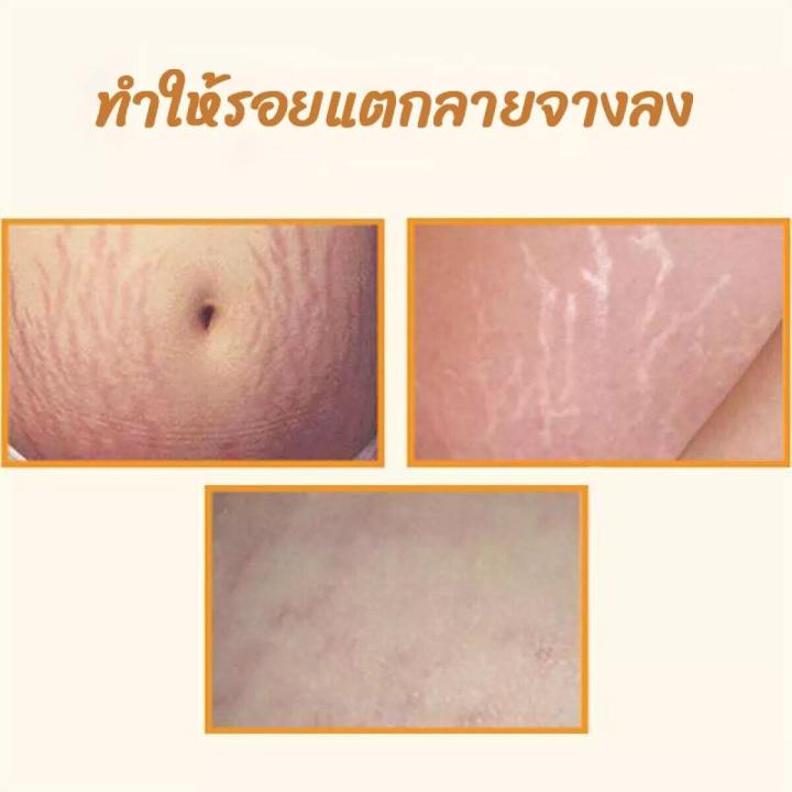 bio-oil-ไบโอออยล์-น้ำมันสกัดบำรุงและรักษาผิวแตกลาย-200-มล