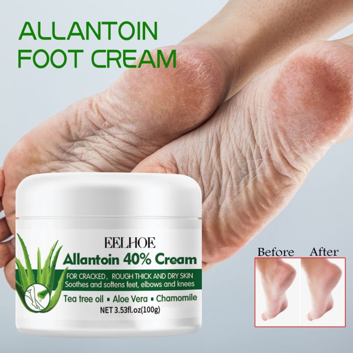 Salicylic acid for cracked on sale feet