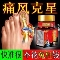 Special Effect Gout Ointment Stone Crystal Big Toe Swelling Finger Joint Pain Nemesis And Relief