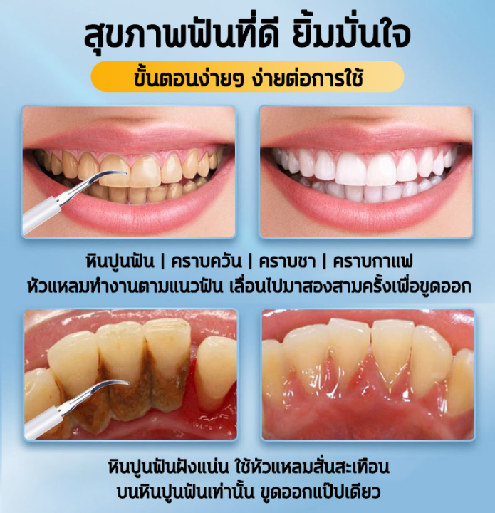 เครื่องขูดหินปูน-ฟันผุ-ขจัดคราบหินปูน-เครื่องทำความสะอาดฟัน-เครื่องขูดหินปูนไฟฟ้า-2ใน1-ขจัดหินปูนฟัน-แปรงฟันที่-ขูดหินปูน-ชุดขูดหินปูน-เครื่องขัดฟัน-ที่ขูดหินปูนฟัน-ปรับได้-5-โหมด