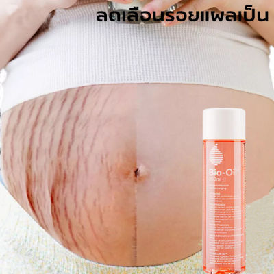 จัดส่งในวันเดียวกัน Bio oil 200ml ไบ โอออยล์ ลดเลือนรอยแผลเป็น ผิวแตกลาย ให้ดูจางลง บำรุงผิว ป้องกันรอยแตกลาย ลดผิวลายที่เติบโต ไบโอออยล์แท้ ไบโอออย ไบโอ ออยล์