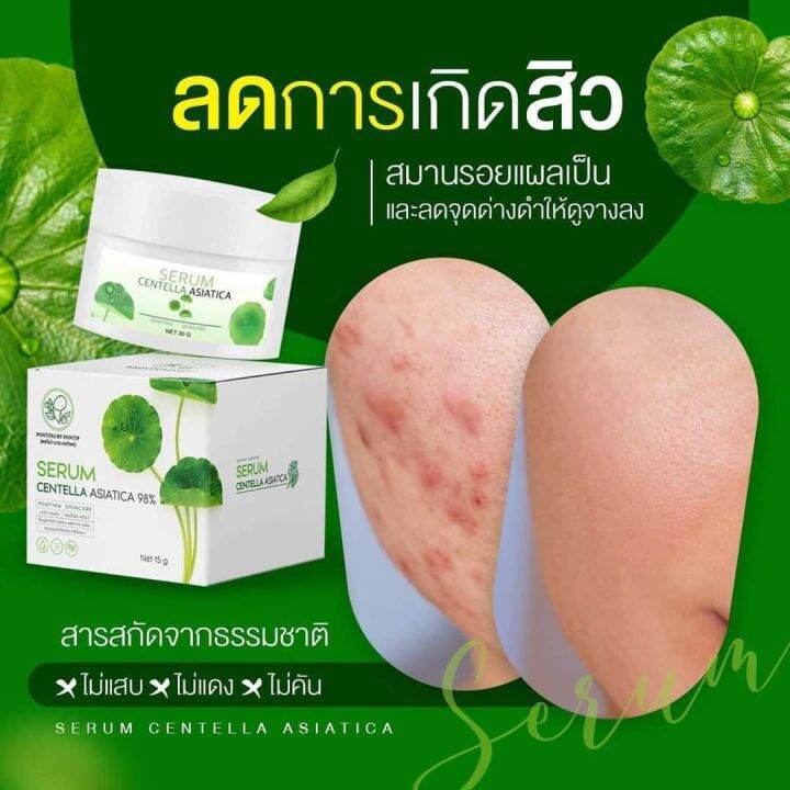 เซรั่มใบบัวบก-ผสมว่านหางจระเข้-ลดสิว-หน้าใส