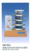 Kang Yi card ZM1022 spinal reflex and damage performance of electric model