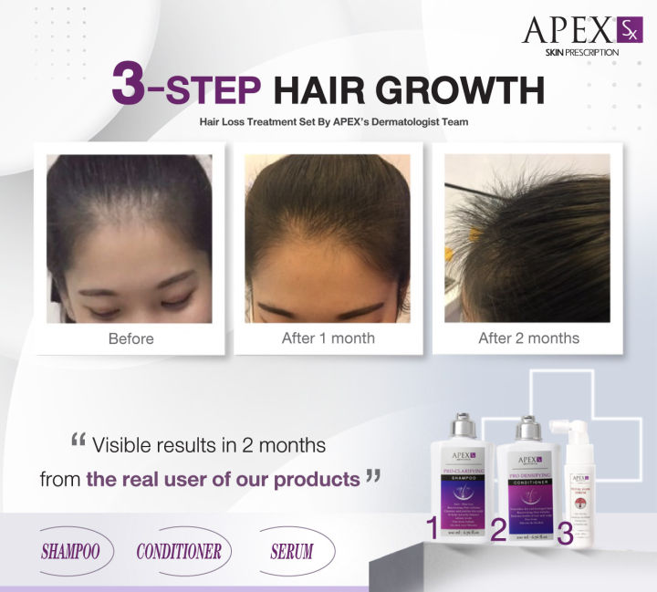 3-step-hair-growth-ชุด-สระ-นวดพ่น-ชุดลดผมร่วงกระตุ้นการงอกใหม่ของเส้นผม