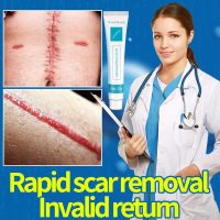 Scar Removal Cream Fast Remove Scars Effectively Treat Skin Surgery Scars Stretch Marks Acne Pox Prints Burn Scars Facial Gel in stock