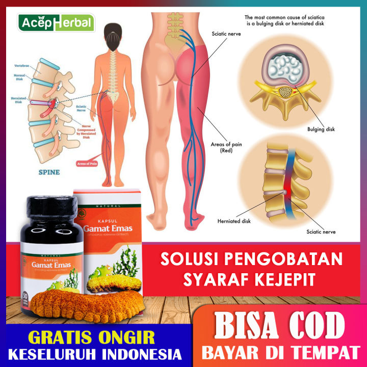 Obat Syaraf Kejepit Sakit Urat Syaraf Tulang Belakang Syaraf