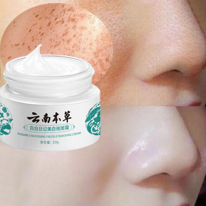 Japanese Melasma Cream Yunnan Herbal Whitening Freckle Cream