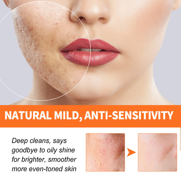 Carrot Deep Clean Facial Care Bubble Mask Gentle Safe Formula