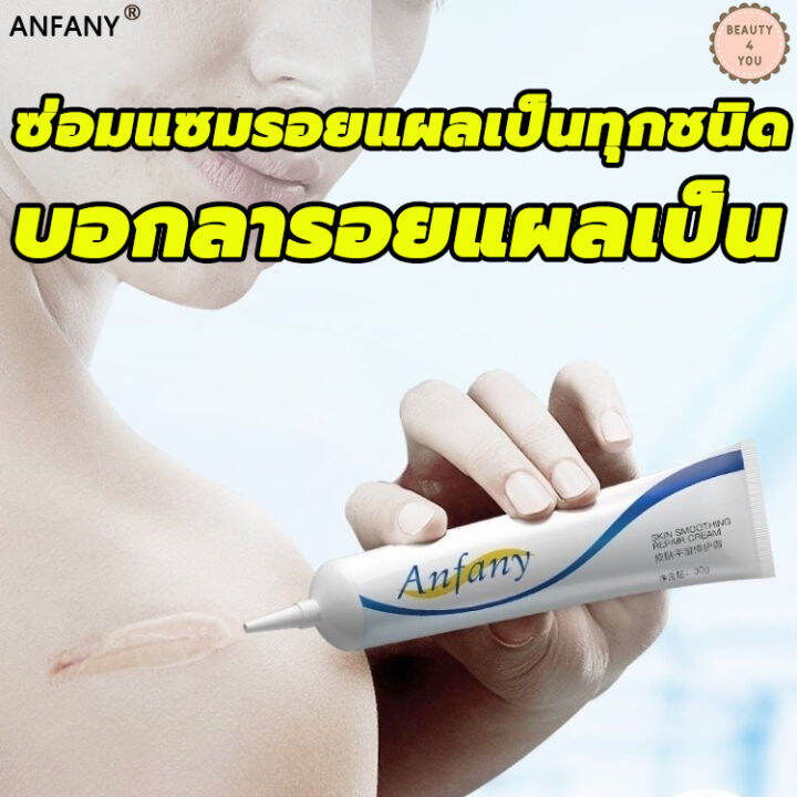 Anfany ครีมลดรอยแผลเป็น 30g กำกัดแผลเป็นทุกชนิดได้อย่างมี ซ่อมแซมรอยแผลต่างๆ ลดแผลเป็นไฟไหม้ ให้