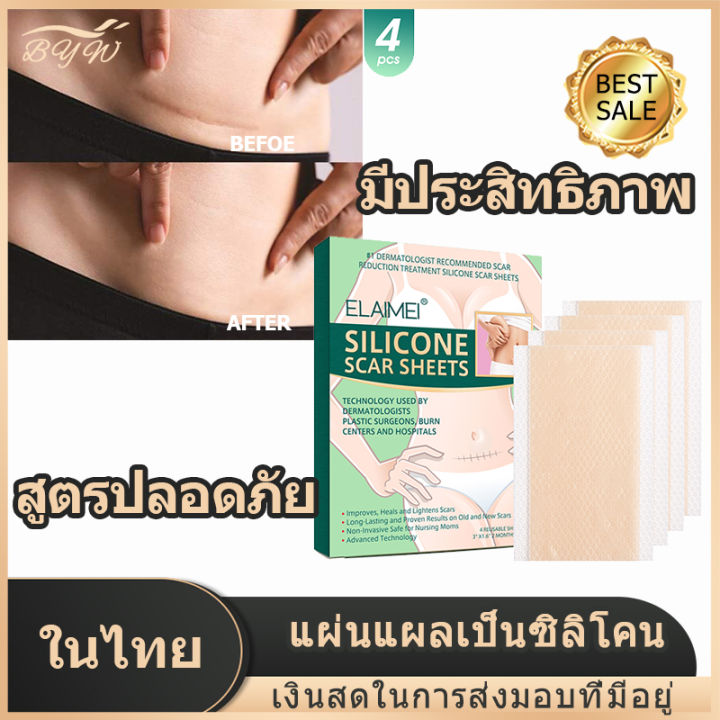 มีcod-แผ่นแปะแผลเป็น-4pcs-ซ่อมแซมรอยแตกลาย-แผลผ่าตัด-แผลผ่าตัดหลังคลอด-สติกเกอร์ความงาม