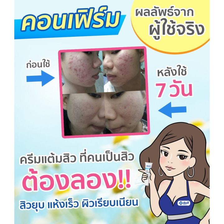 ครีมยันฮี-ครีมแต้มสิว-ของแท้100-สลายสิวอุดตัน-ลดปัญหาสิวอักเสบ-ขนาด10g-สินค้าพร้อมส่ง