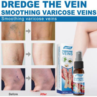 【UClanka】South Moon Varicose Vein Cure Spray บรรเทา Phlebitis Vasculitis บรรเทาอาการปวดสเปรย์ Spider Vein Edema Neuralgia Earthworm ขา