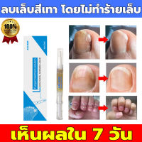 EELHOE เอสเซ้นซ่อมแซมเล็บ แก้ไขปัญหา​เล็บ​หนาที่ก่อตัวนานจากเชื้อรา Nail Repair Essence Serum Nail Treatment เซรั่มบำรุงเล็บ