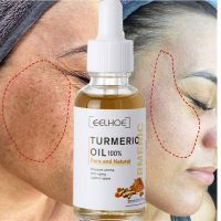 Turmeric Freckle Serum Whitening Dark Spots Organic Turmeric Oils Brighten Dark Skin Pigment Anti Aging Wrinkle Moisturizer Care