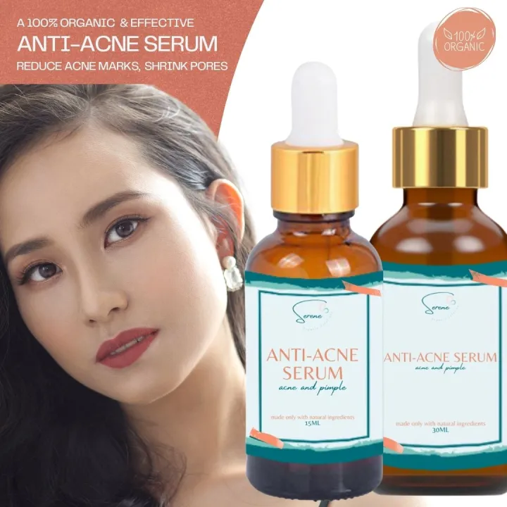 30ml Pure Organic & Effective Anti-Acne and Pimple Remover Serum | 100% ...