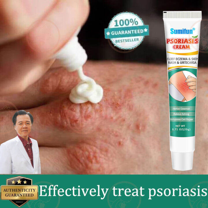 【Sumifun】 Psoriasis Cream Antibacterial Cream Eczema Ointment Eczema