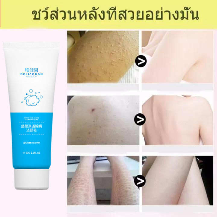 hyqing-shower-gel-260ml-ครีมอาบน้ำกำจัดไร-เจลอาบน้ำ-สบู่อาบน้ำครีมอาบน้ำ-ครีมอาบน้ำขาว-สบู่อาบน้ำครีมอาบน้ำ-ป้องกันผิวแห้ง