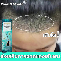 ?บอกลาหัวล้าน?สเปรย์ปลูกผม เร่งผมขึ้นใหม่ เร่งผมยาวไว ป้องกันผมร่วง ป้องกันผมร่วงอย่างมืออาชีพ แก้ปัญหาผมร่วง ลดผมร่วง(น้ำยาใส่ผม ยาปลูกผม น้ำยาปลูกผม น้ำยาเร่งผมยาว เซรั่มปลูกผม ปลูกผมเร่งด่วน ปลูกผม ยาปลูกผมผู้ชาย)Hair Growth