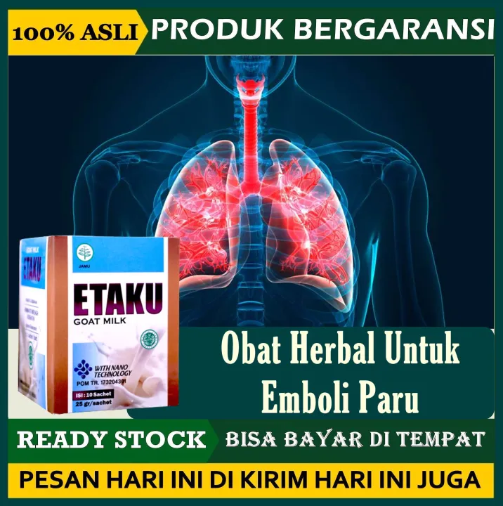 Obat Herbal Untuk Emboli Paru, Obat Penyumbatan Paru Paru Anak & Dewasa ...