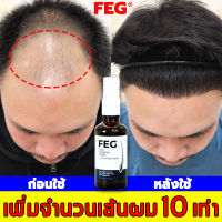 ไม่หัวล้านตั้งแต่นั้นมา FEG น้ำยาปลูกผม 50ml เร่งการเจริญเติบโตของเส้นผม แก้ปัญหาผมร่วง.เร่งผมยาวไว ปลูกผมเร่งด่วน สเปรย์ปลูกผม เซรั่มบำรุงผม น้ำมันปลูกผม นํ้ายาปลูกผม เซรั่มปลูกผมดก เร่งผมงอกใหม่ น้ำยาใส่ผม ยาปลูกผมหญิง ยาปลูกผมของแท้ น้ำยาเร่งผมยาว