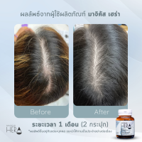 Magicus Hera มาจิคัส เฮร่า 2 ขวด ผลิตภัณฑ์เสริมอาหาร เพื่อผู้มีปัญหาผมร่วง ผมบาง แถมฟรี งาดำคั่วบด 1 กล่อง