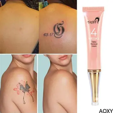 Tattoo Removal Cream Natural Fading system wrecking India  Ubuy