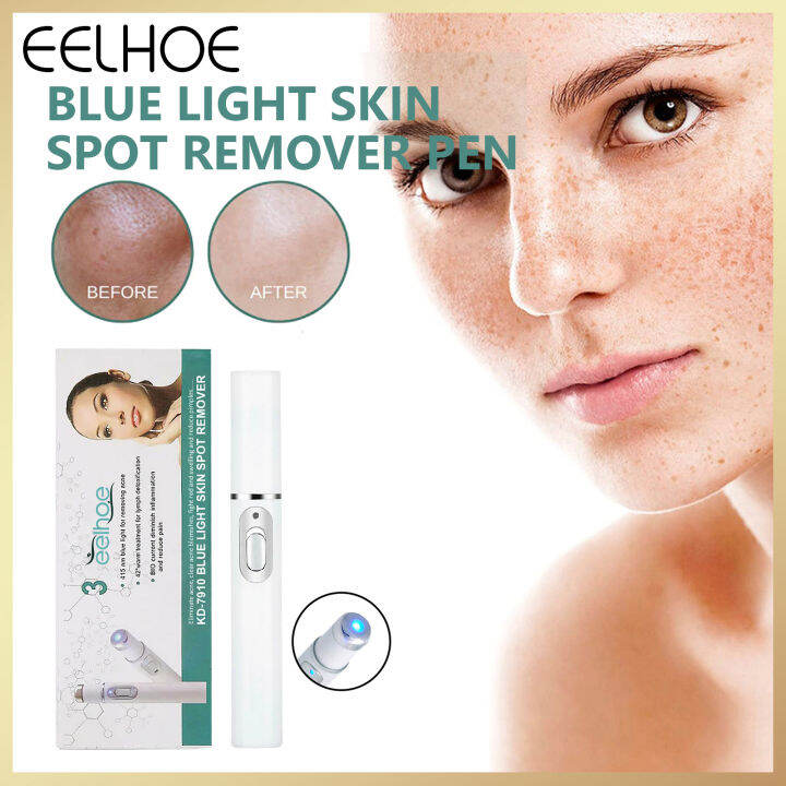 Eelhoe Blue Light Fade Dot Pen Remove Melasma Remove Dark Spots Melanin