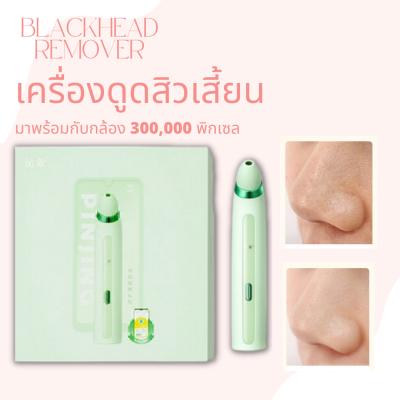 ที่ดูดสิวเสี้ยน SOOCAS PINJING Blackhead Remover ดูดสิวเสี้ยน เครื่องดูดสิว สามารถซูมได้ 16 เท่า หัวดูดให้ 2 ขนาด