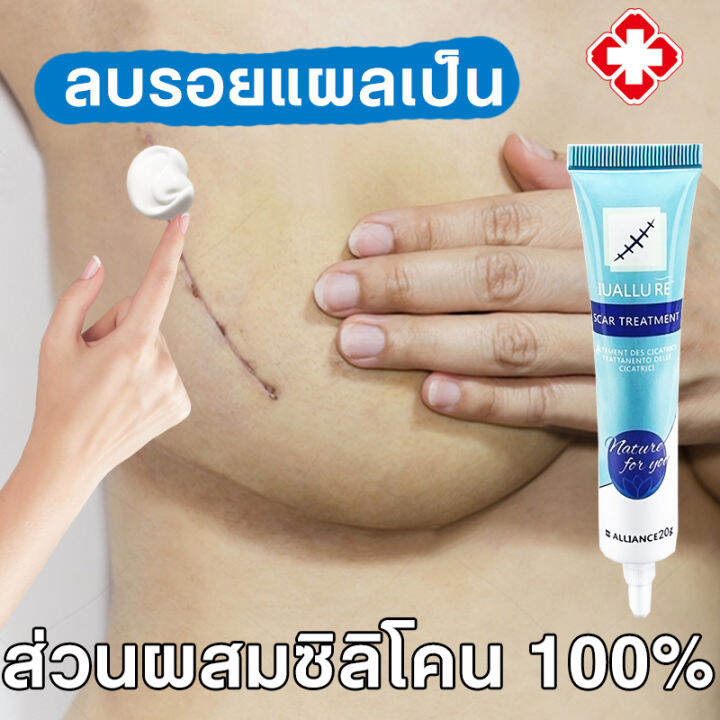 ครีมลบแผลเป็น ครีมทาแผลเป็น ลดรอยสิว รอยดำ Iuallure ของแท้ ยาทาแผลคีลอยด์ ครีมทาแผลเป็น  ครีมทาแผลผ่าคลอด ลดแผลไฟไหม้ แผลน้ำร้อนลวก แผลผ่าตัดเป็นต้ Scar Removal  Cream ยาทาแผลเป็น | Lazada.Co.Th