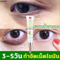 ? Aichun กำจัดเม็ดไขมัน อายครีม เซรั่มรอบดวงตา 30ml ขจัดตา เพิ่มความชุ่มชื่น กำจัดถุงใต้ตา เม็ดไขมัน ครีมบำรุงรอบ ลดเม็ด [ ของมีจำนวนจำกัด ]