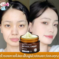 ครีมเรตินอล ครีมต่อต้านริ้วรอย เรตินอลครีมแท้ retinol cream แท้ ครีมเรตินอล ครีมลบริ้วรอย ครีมบำรุงหน้า ครีมบำรุงหน้าเกาหลี ครีมหน้าเด็ก