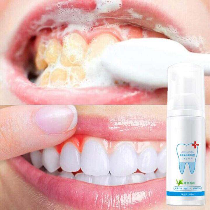 [COD] Teeth Whitening Teeth Cleaning Mousse White Teeth Oral Hygiene ...