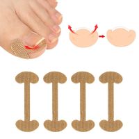 ▦ Toenail Stickers Nail Groove Ingrown Nail Foot Nail Corrector Thumb Roll Nail Patch Fast Manicure Toenail Nail 2Pcs