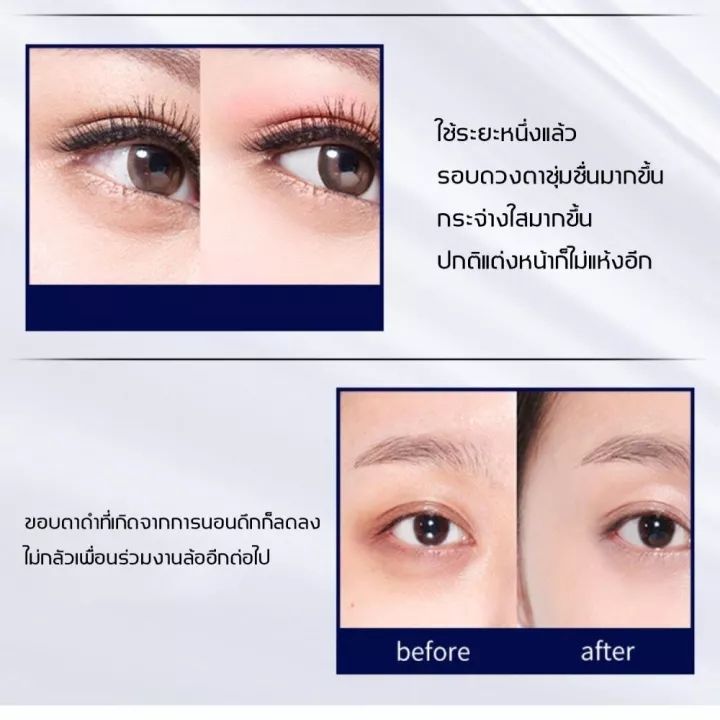 ซื้อ-2-แถม-1-aichun-ครีมบำรุงใต้ตา-เซรั่มทาถุงใต้ตา-30ml-คนีมบำรุงรอบดวงตา-ครีมทาตาเม็ดไขมัน-ครีมบำรุงรอบตา-เซรั่มถุงใต้ตา-ครีมทาใต้ตาดำ-บำรุงสายตา-ครีมทาตาดำ