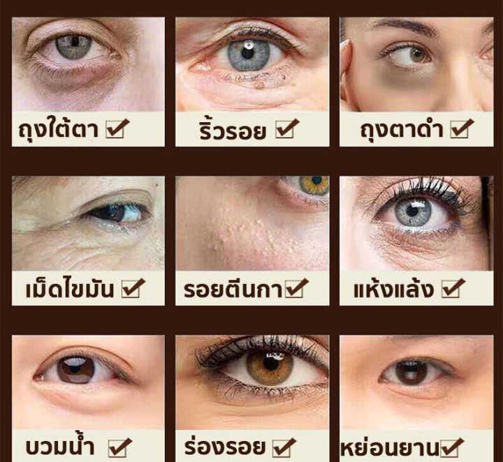 ครีมลดถุงใต้ตา-ลดถุงใต้ตา-ที่มาร์คใต้ตา-ขอบตาดำ-มาคใต้ตา-ลบถุงใต้ตา-ครีมทาถุงใต้ตา-ครีมลบถุงใต้ตา-อายครีม-ครีมบำรุงรอบตา-ครีมลบใต้ตาดำ-ครีมทารอบดวงตา-ครีมแก้ขอบตาดำ-eye-cream
