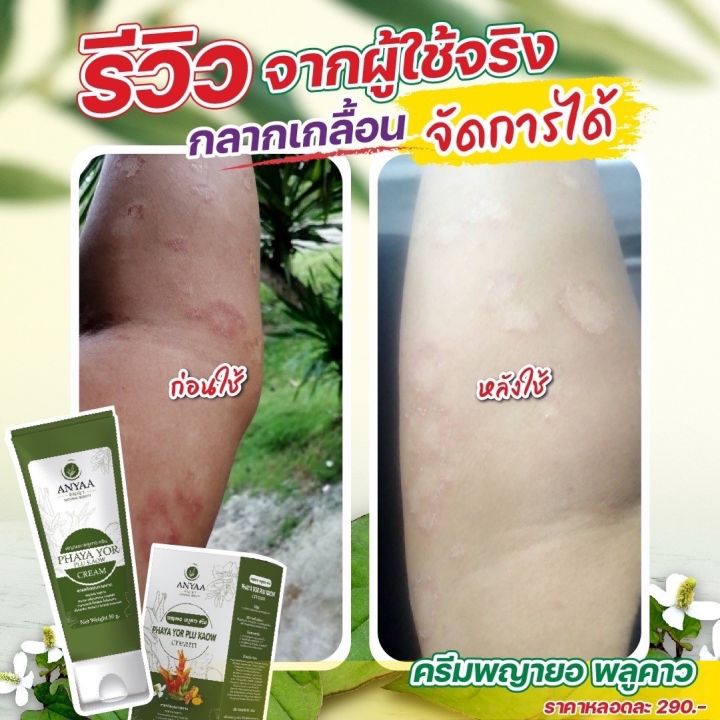 ครีม3หลอด-580-ครีมพญายอพลูคาว-ครีมแก้คัน-เชื้อรา-ของแท้จากบริษัท