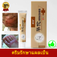 ของแท้แน่นอนช่วยให้แผลไฟไหม้น้ำร้อนลวกและรอยแผลเป็นหายสนิท ！ครีมทาแผลน้ำร้อนลวก ครีมทาน้ำร้อนลวก ครีมทาแผลไฟไหม้ ครีมรักษาแผลเป็น