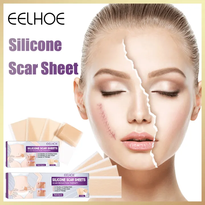 Eelhoe Silicone Scar Sheets Efficient Beauty Scar Removal Patch Surgery