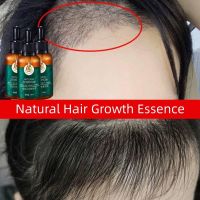 【cw】 Hair Growth Products Ginger Anti Hair Loss Essential Oil Treatment Hair Thinning Dry Frizzy Damaged Repair Essence For Men Women ！