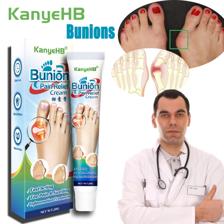 KanyeHB Bunions Split Pain Relief Cream Soothing Elbow Tendon Ointment ...