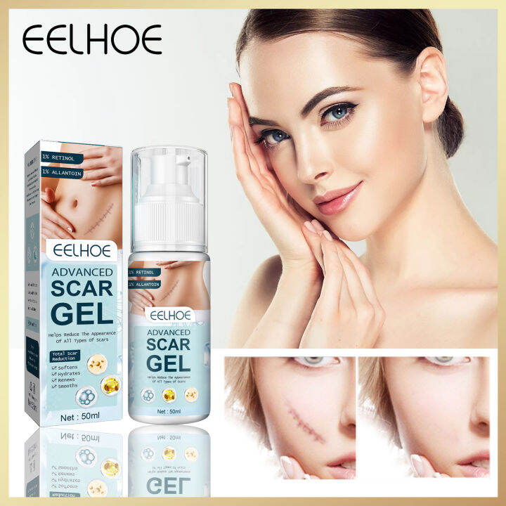 Eelhoe Advanced Scar Gel Effective Acne Scar Removal Face Cream Pimples Stretch Marks Remove