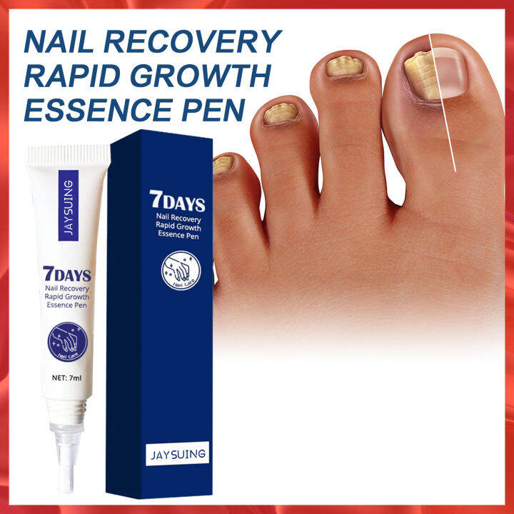 Jaysuing 7 Days Nail Recovery Rapid Growth Essence Pen Toe Nails Fungal Onychomycosis Paronychia