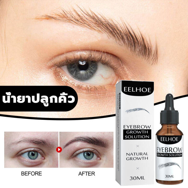 product-details-of-eelhoeเซรั่มปลูกหนวด-30ml-ปลูกคิ้ว-ปลูกคิ้วดกดำ-ปลูกคิ้วของแท้-บำรุงขนตายาว-เซรั่มปลูกคิ้ว-น้ำยาปลูกคิ้ว-น้ำยาเร่งคิ้ว-น้ำยาปลุกคิ้ว-ยาปลูกขนคิ้ว-เชรั่มปลูกคิ้ว-เซรั่มทาคิ้วดก-เซรั่