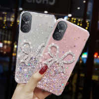 เคสสำหรับ Huawei Nova 9 SE เคสโทรศัพท์ประดับพลอยเทียมรูปดาวบนท้องฟ้าระยิบระยับสุดหรูเคสป้องกันซิลิโคนแบบนิ่มสำหรับหญิงสาว