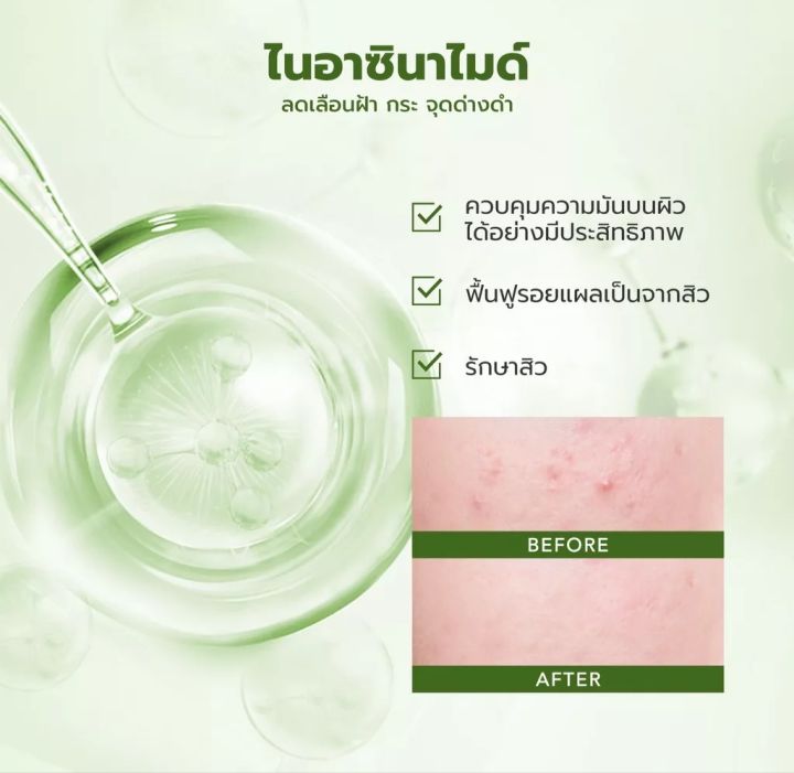 y-o-u-วาย-โอ-ยู-บาล์มแต้มสิว-ลดสิว-ลดรอย-ผิวเรียบเนียน-ลดความมันบนใบหน้า-ปราศจากแอลกอฮอล์-exp-7-2025