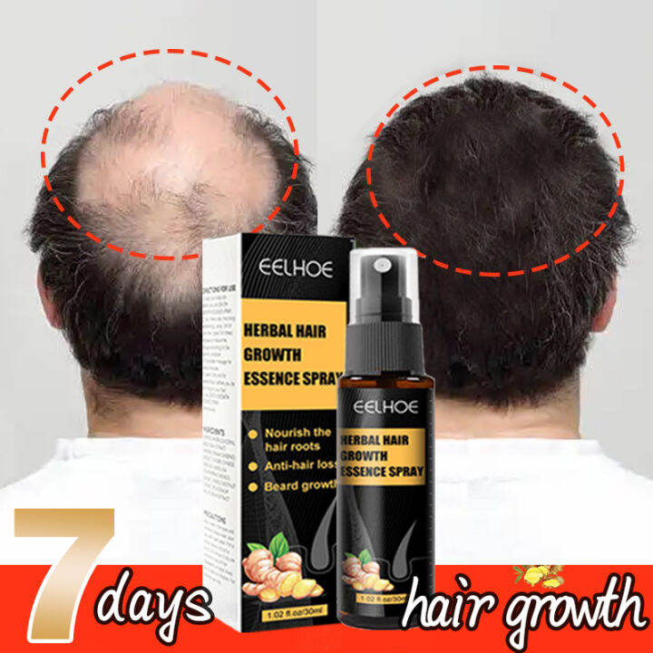 Effective In 7 DaysHair Grower Spray For Men Original Minoxidil Hair effective-in-7-dayshair-grower-spray-for-men-original-minoxidil-hair